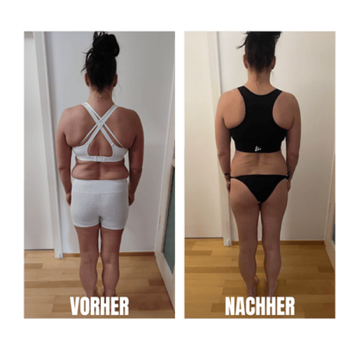 Melanie vorher und nachher